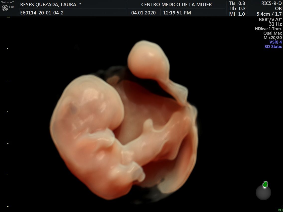 Julio Cesar Monárrez Martín-22