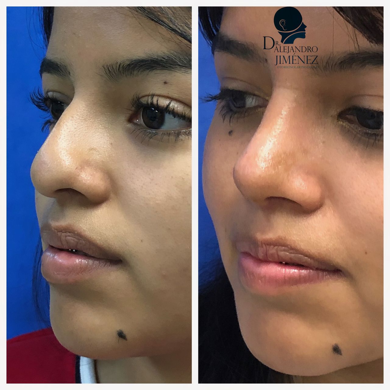 Alejandro Jimenez Garcia-6