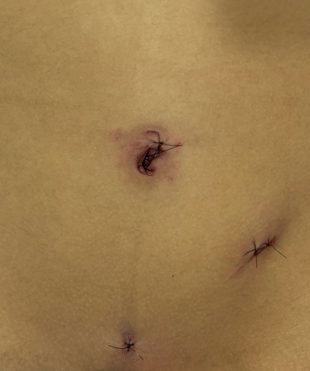 Edgar Raziel Acosta May-0