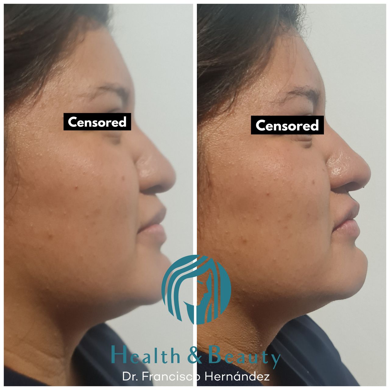 Francisco Hernández Gómez Crespo-101