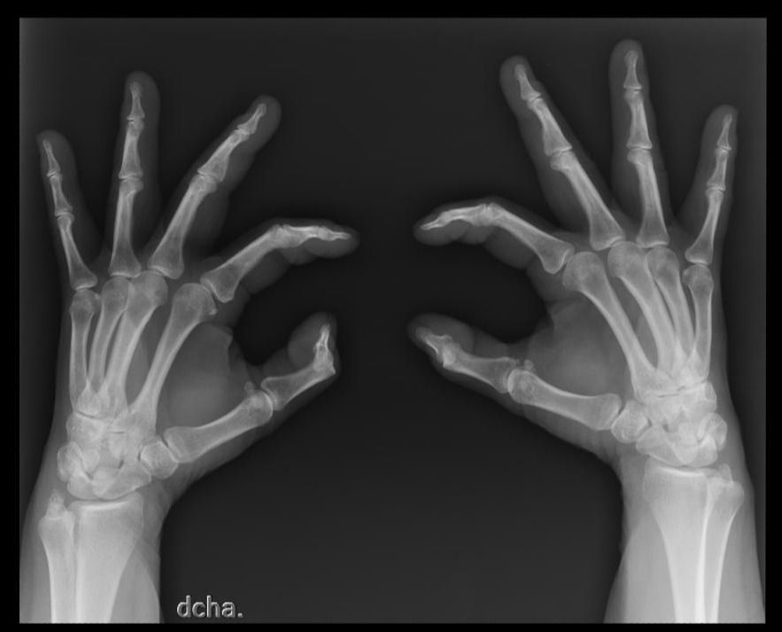 José Antonio Algarín Reyes-44