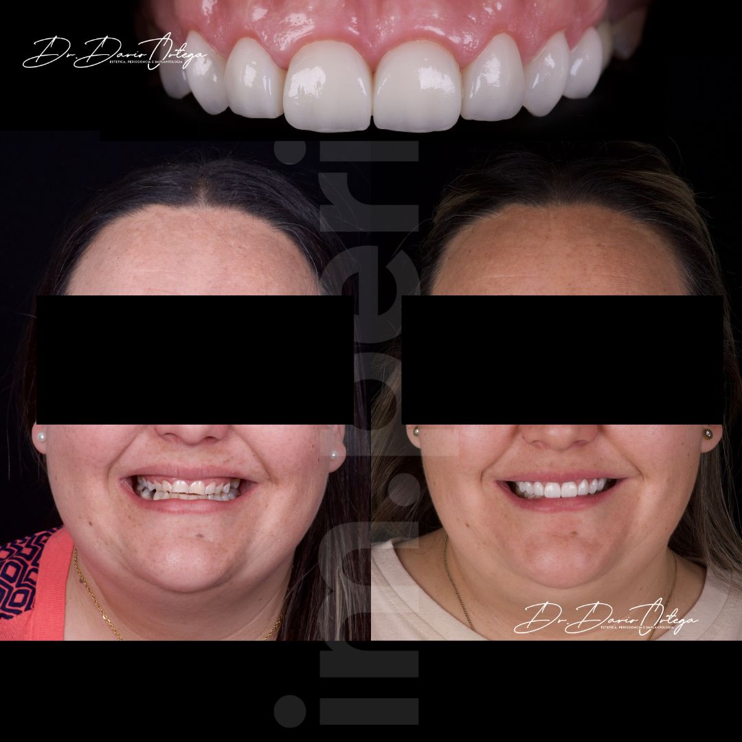 Dario Ortega Aceves-22