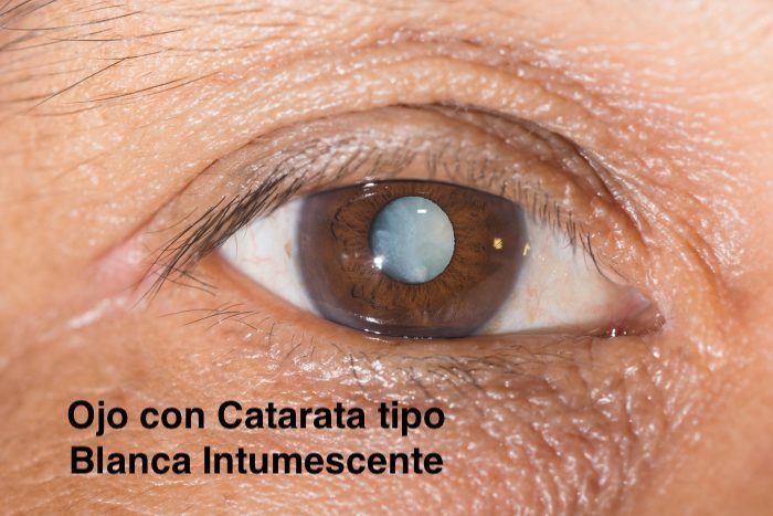 Jesus Luna Briceño-8