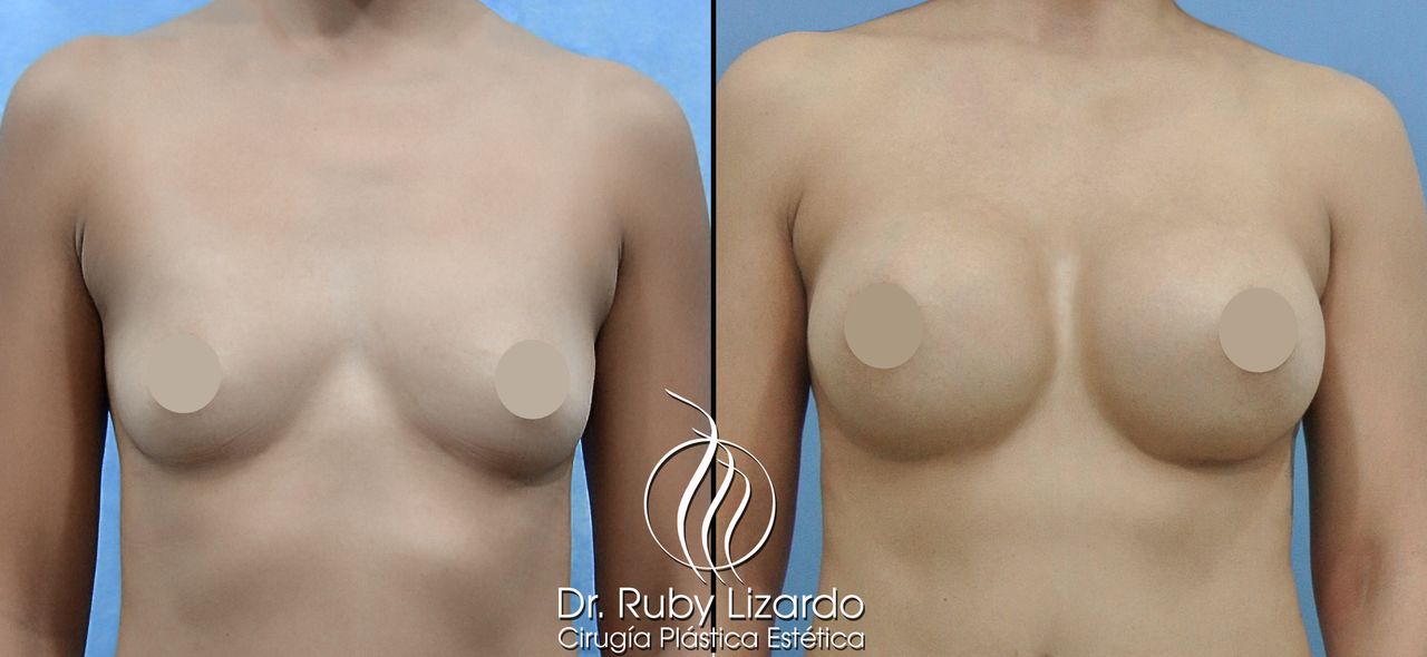 Ruby Lizardo Ramírez Robles-24