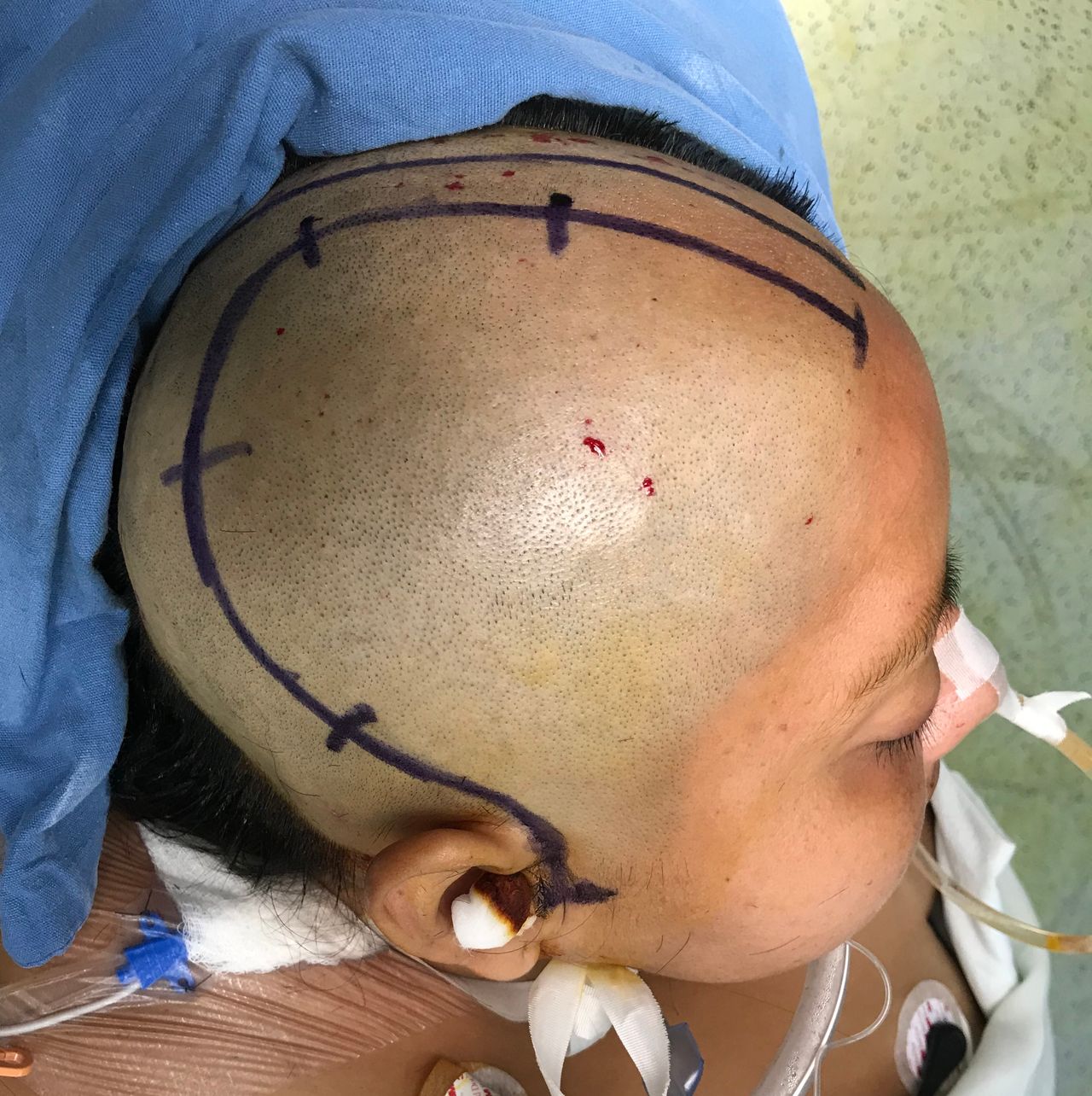 Rafael Maciel Morfin-46