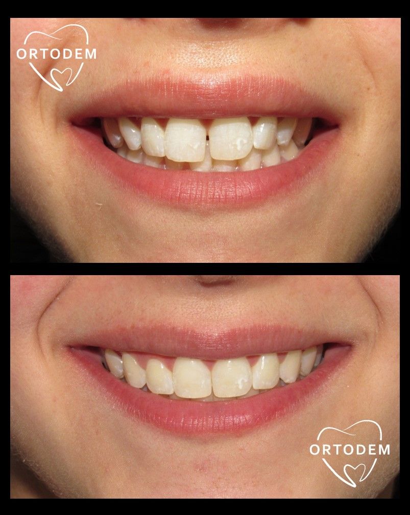 Elizabeth Morelos Morales-20