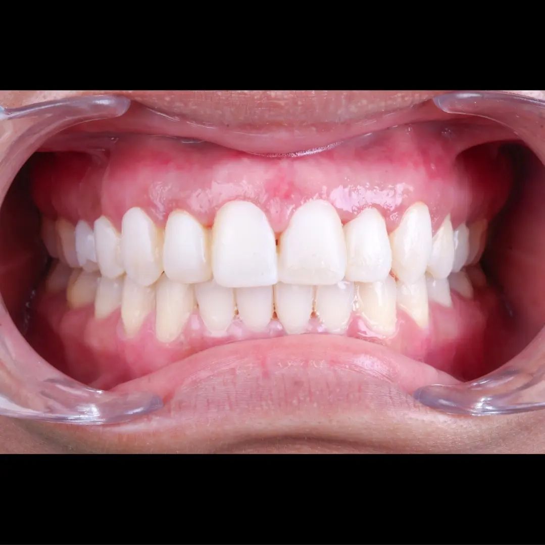 Hugo Enrique Aguilar Lamas-57