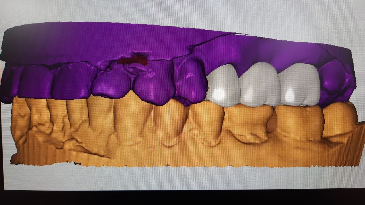 Laura Karla Becerra Gamiño-23