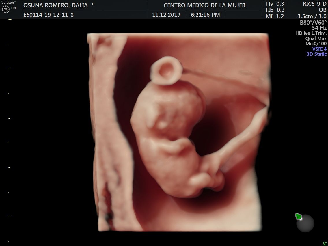 Julio Cesar Monárrez Martín-18