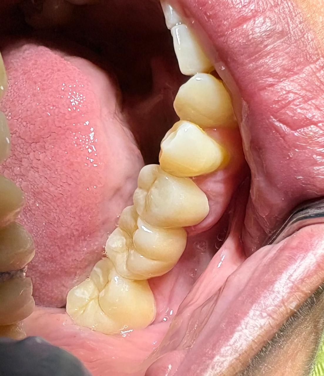 Arturo Romero Grande-47