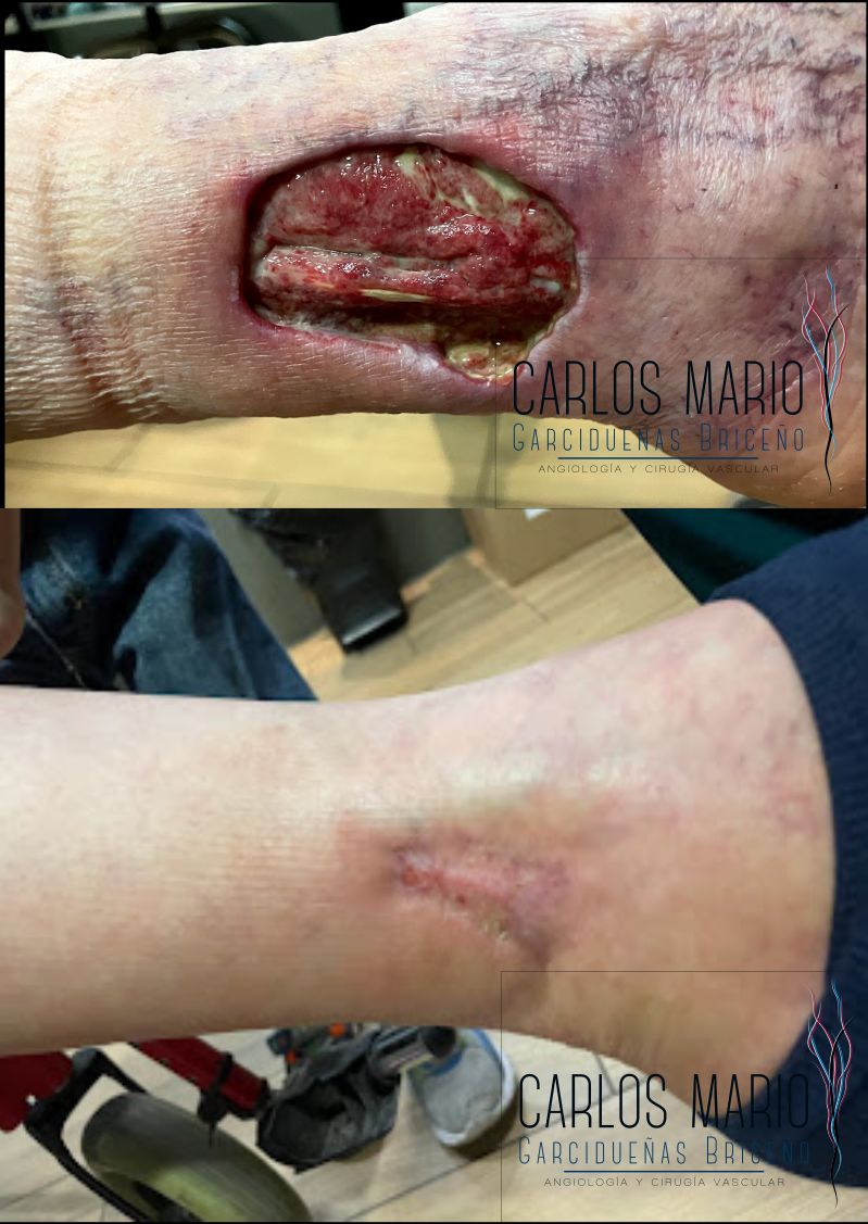 Carlos Mario Garcidueñas Briceño-6