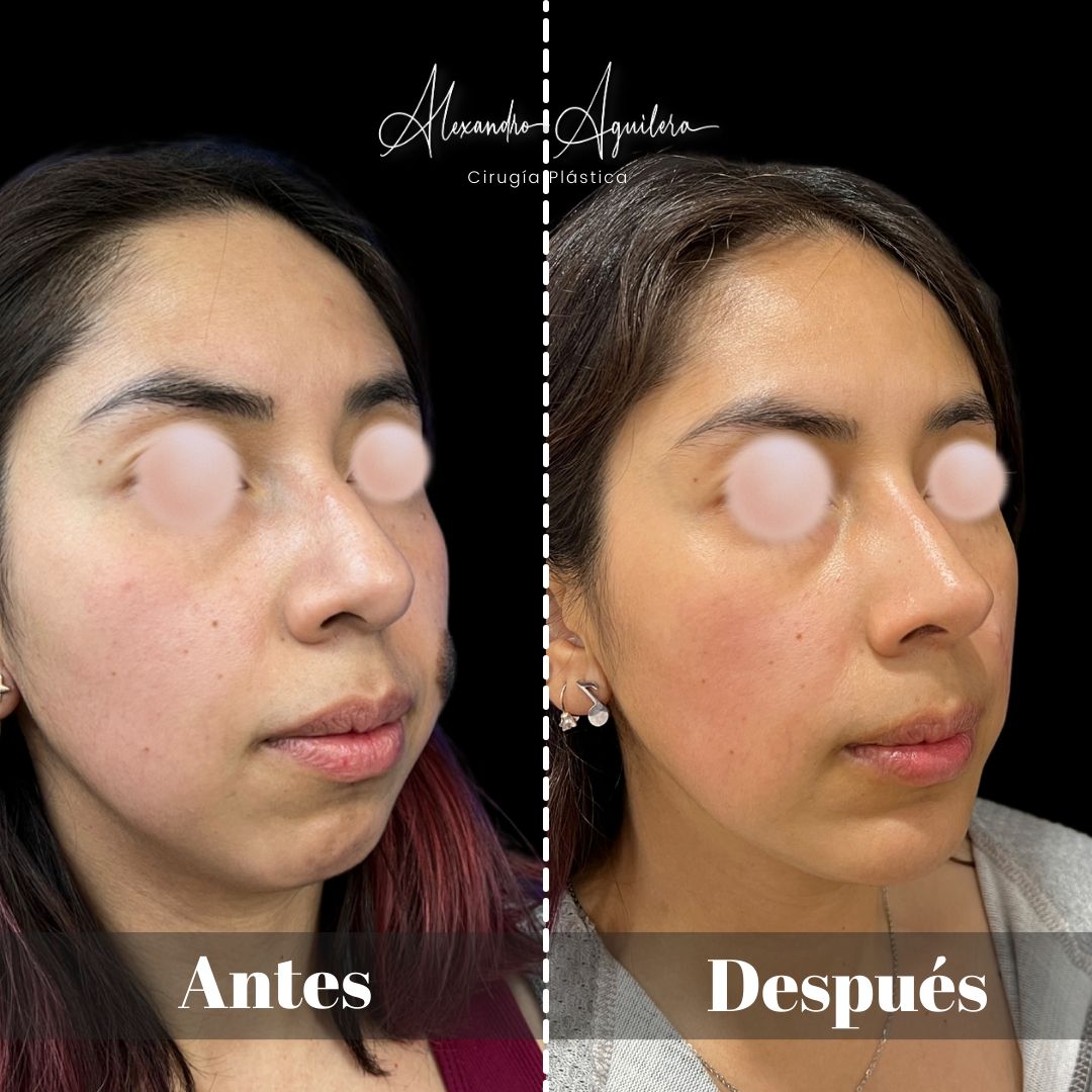 Alexandro Aguilera Salgado-33