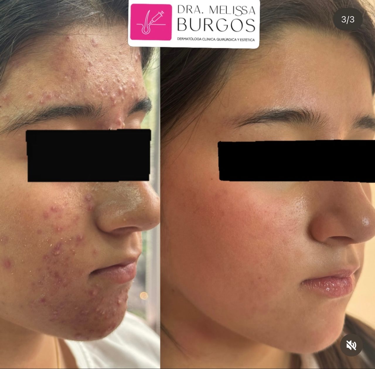 Melissa Burgos Romero-18