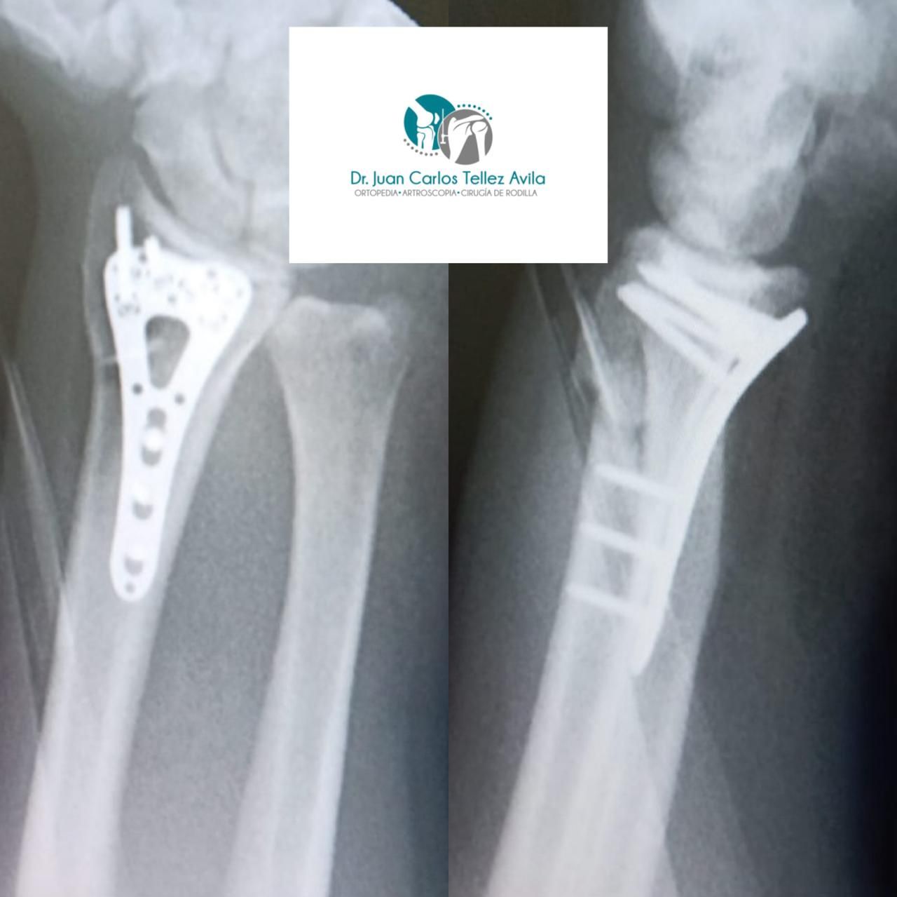 Juan Carlos Tellez Avila-5