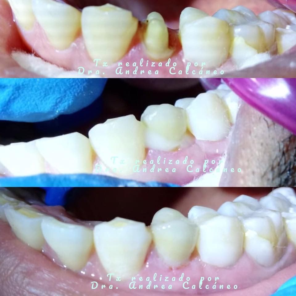 Andrea Calcáneo Castañeda-4