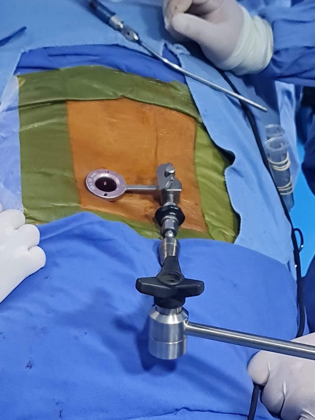 Gerson Reyes Rodríguez-64