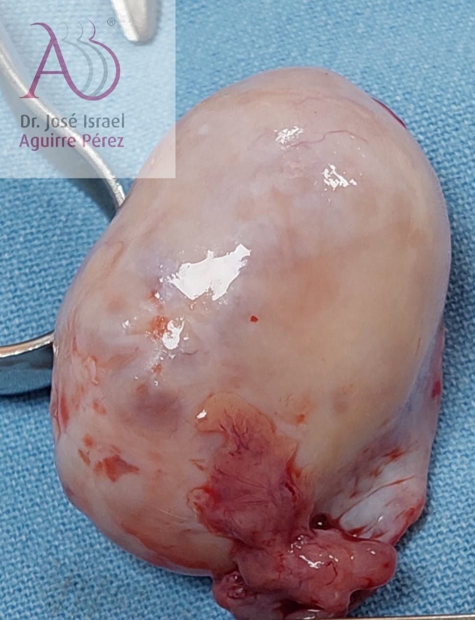 José Israel Aguirre Pérez-8