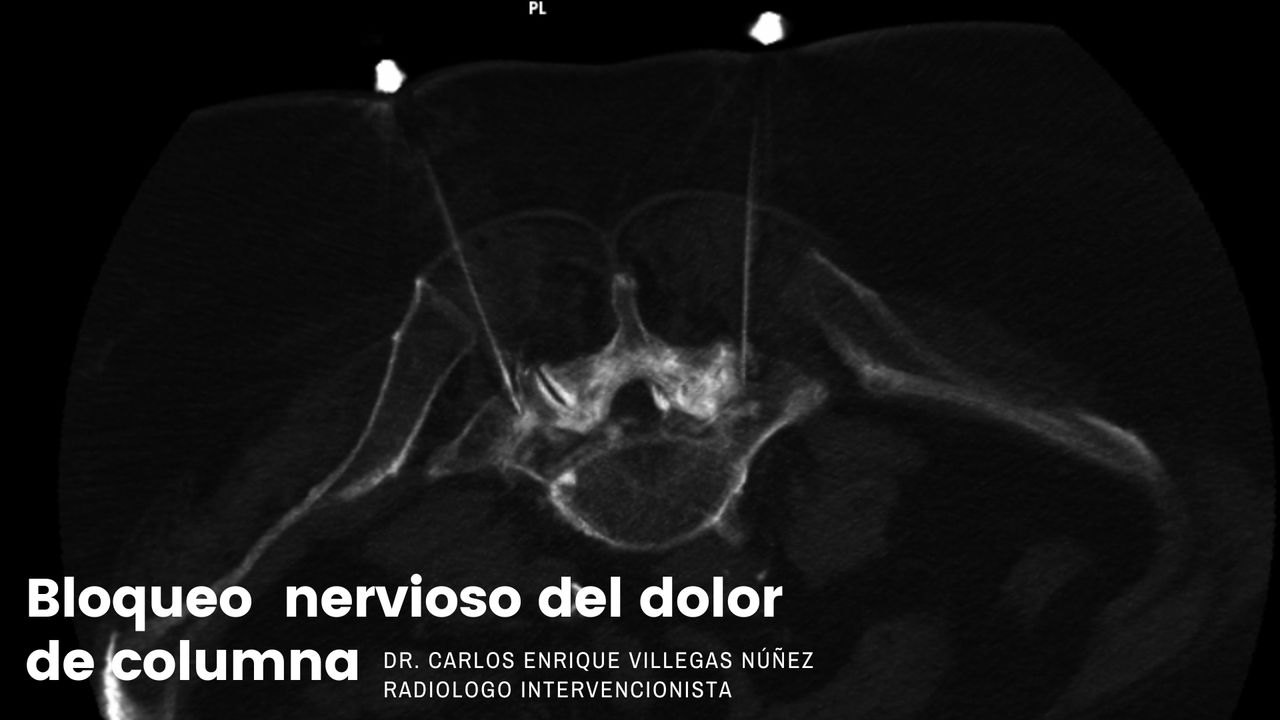 Carlos Enrique Villegas Nuñez-6