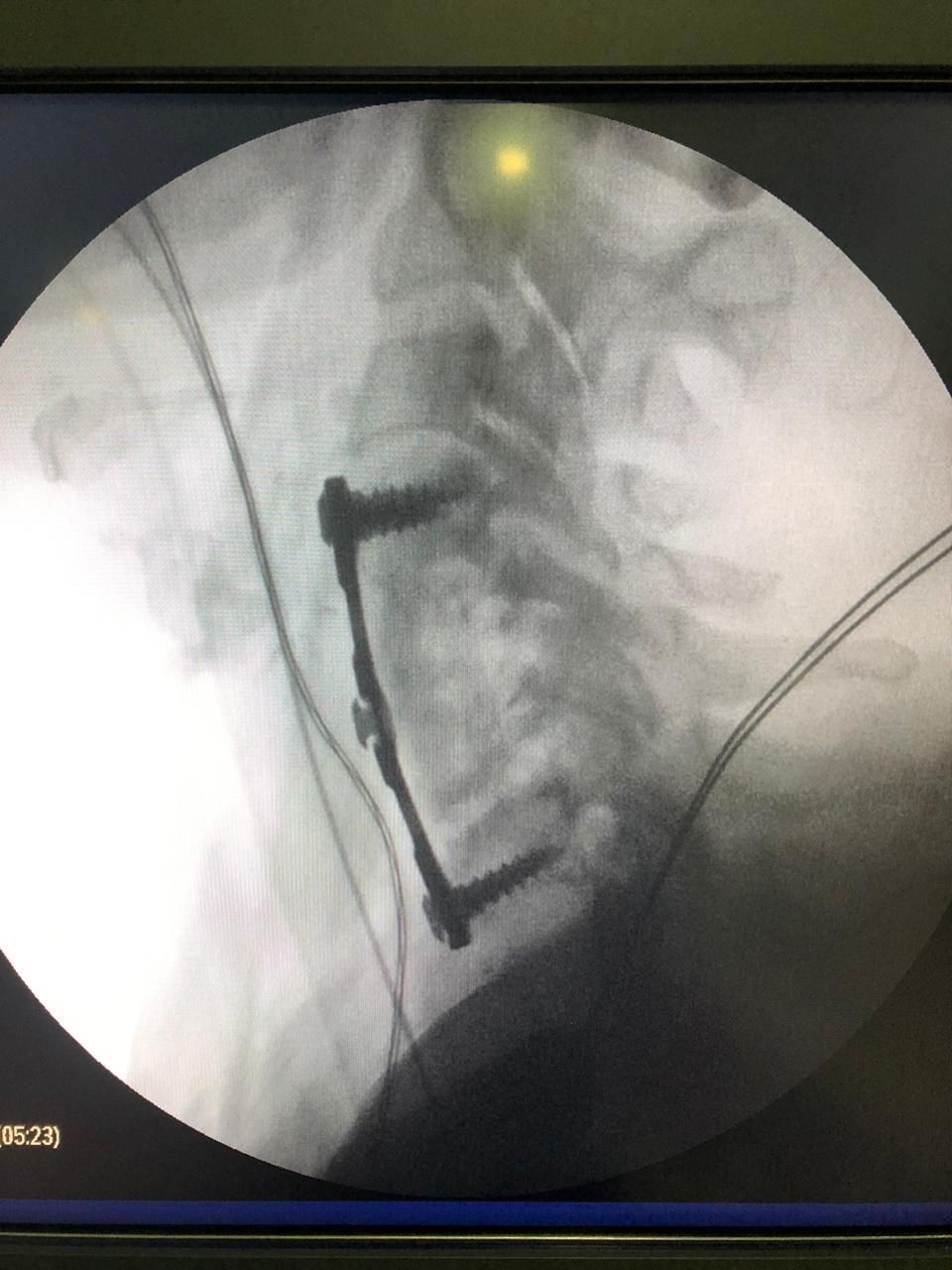 Juan José Luévano De La Cruz-16