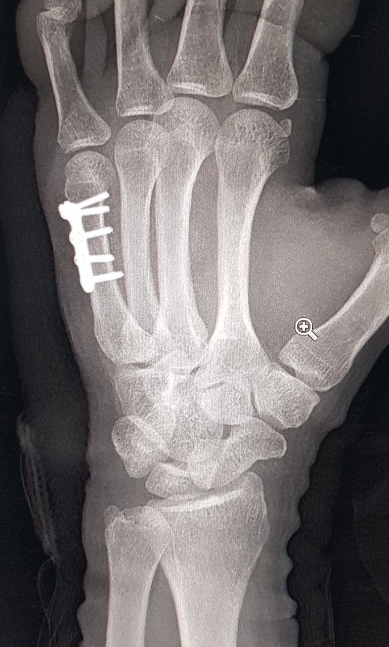 Gilberto Hernández Ortega-47