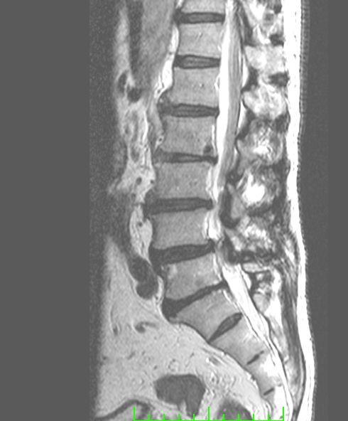 Marco Antonio Díaz Montoya-3