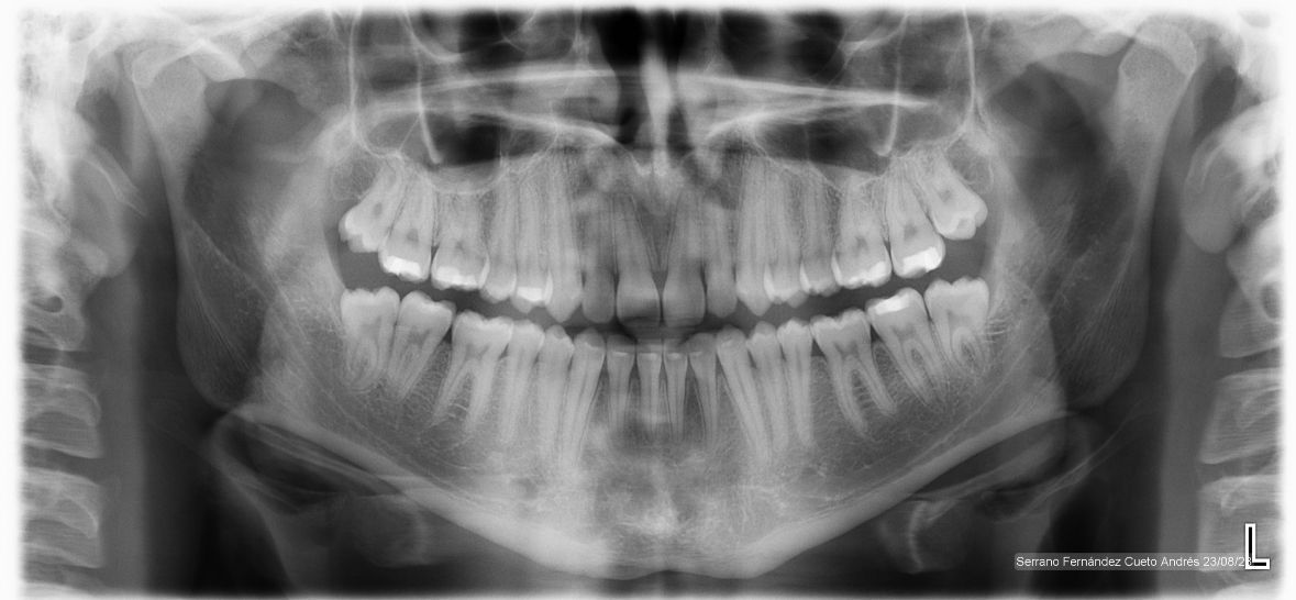 Erendalhi Rocha Mesta-8