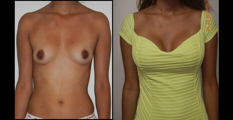 Edgar Ernesto Torres Mejía-14