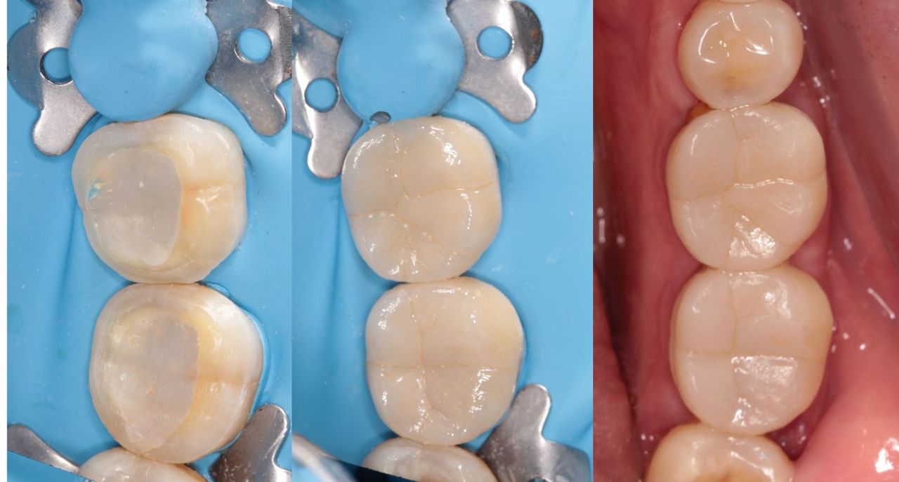 Aide Montserrat Orozco Gutierrez-31