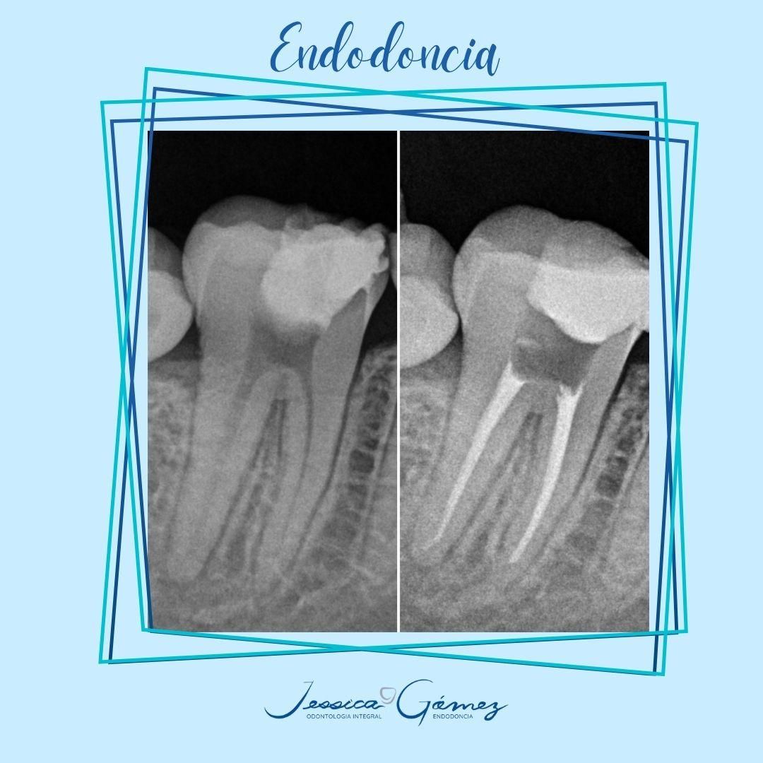 Jessica Gómez Tavizon-11