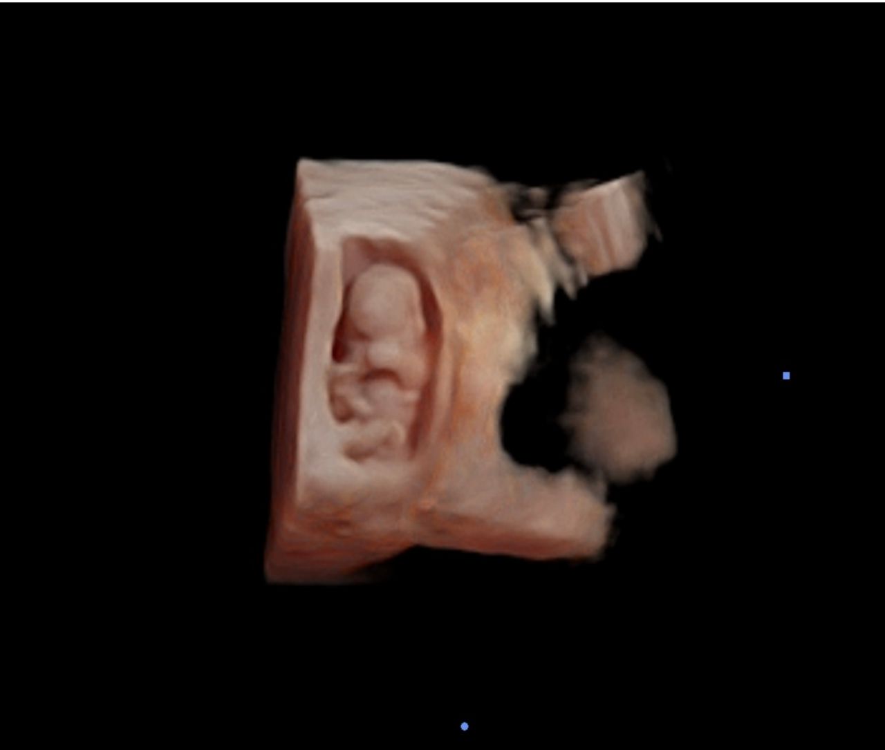 Francisco Carbajal-102