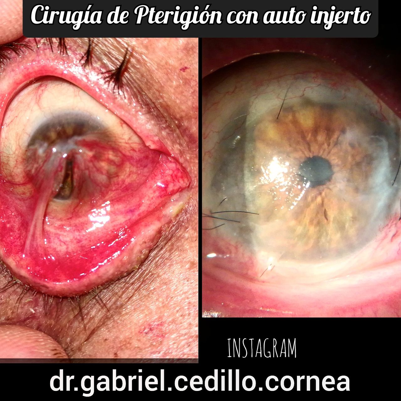 Héctor Gabriel Cedillo García-29