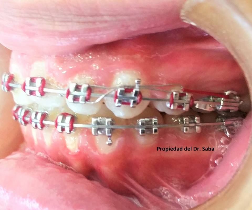 Antonio Saba Sepulveda-4