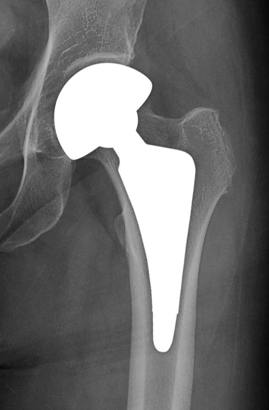 Luis Fernando Martínez-4