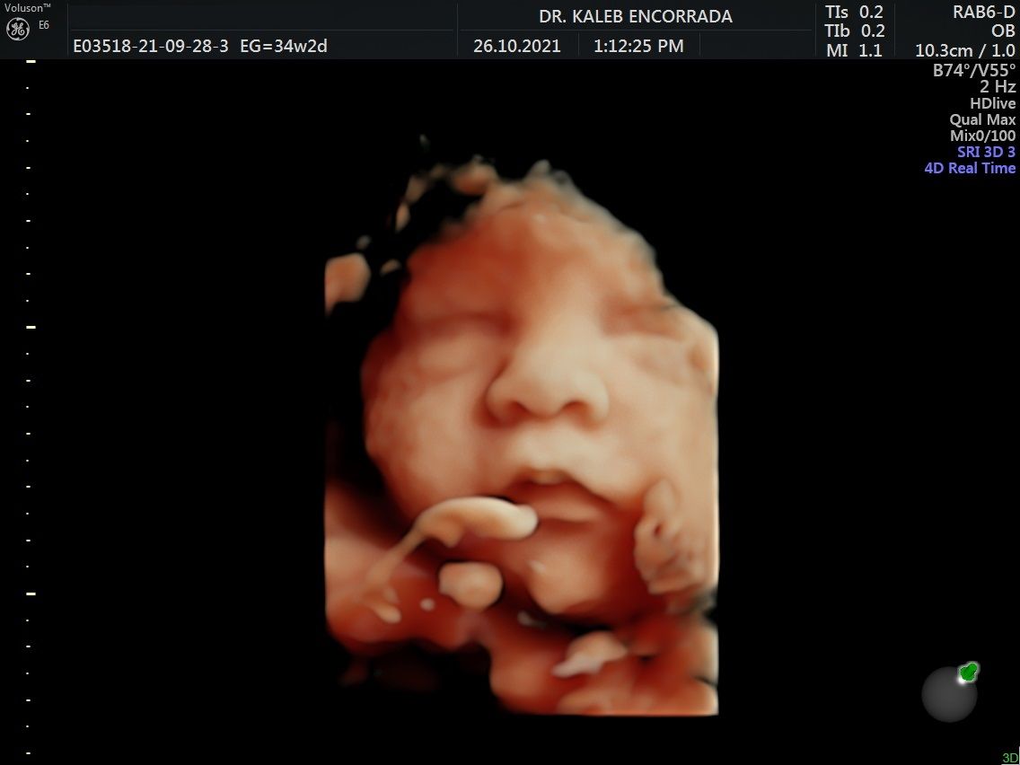 Hugo Kaleb Encorrada Luarca-23