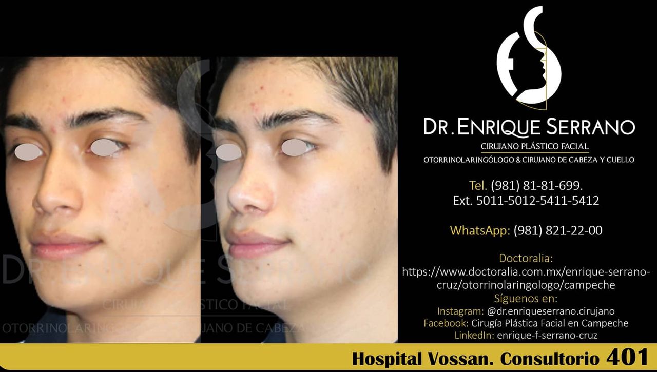 Enrique Serrano Cruz-120