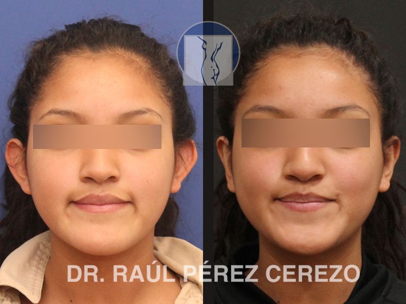 Raúl Pérez Cerezo-11