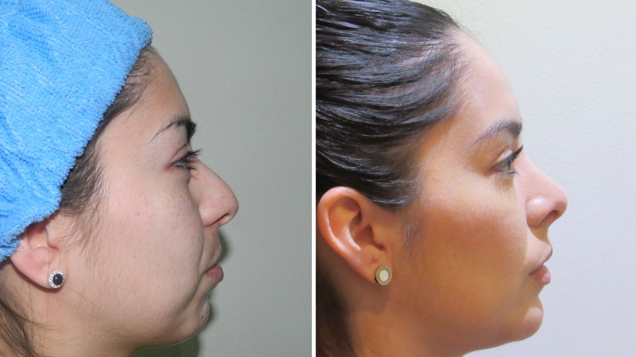 Rogelio Reza Gallegos-20