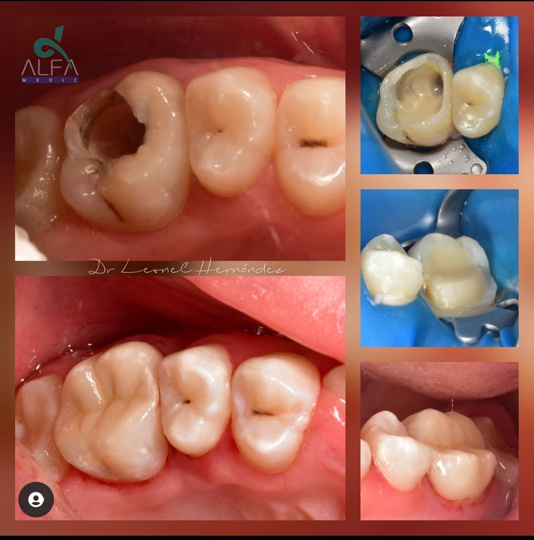 Leonel Hernández Gómez-25