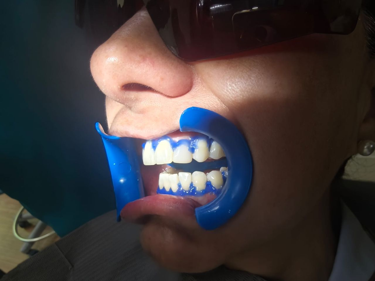 Pedro Badial Aceves-9