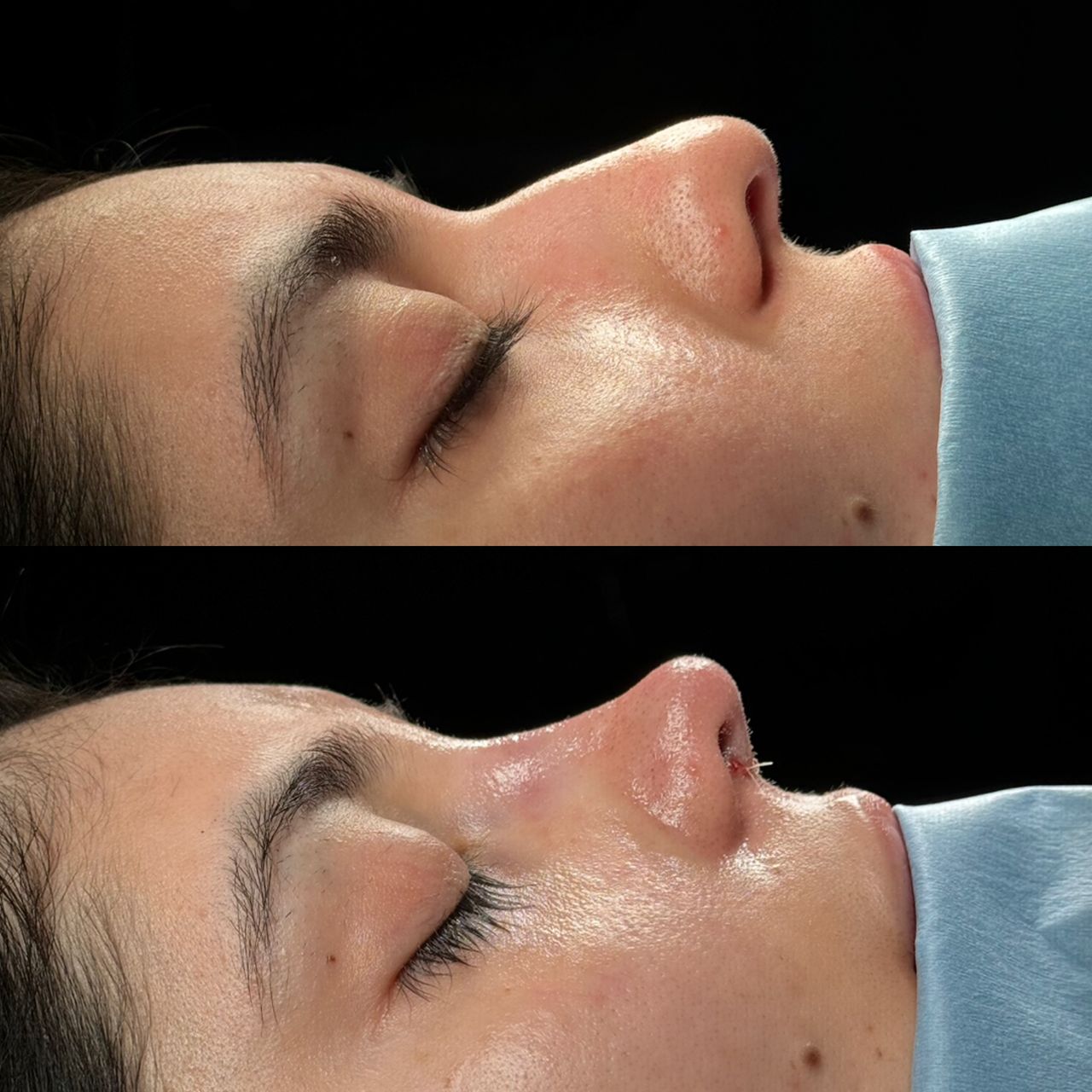 Angel Castro Urquizo-119