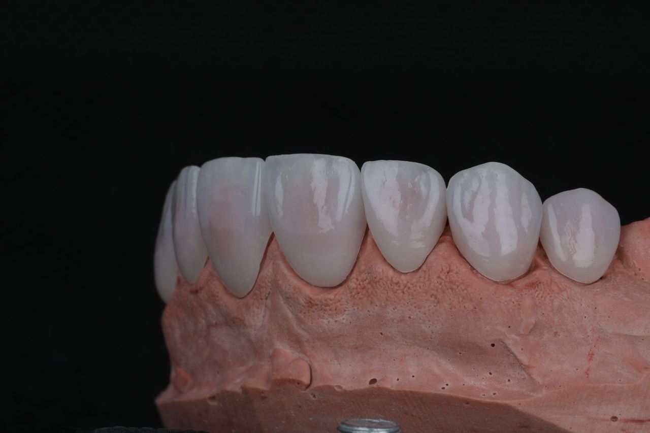 Janeth Arzate Banda-13