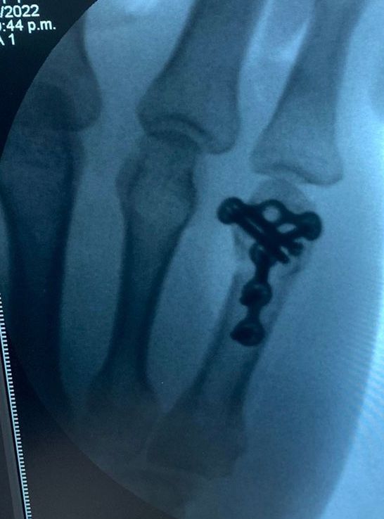 Gabriel Ramírez Lozano-19