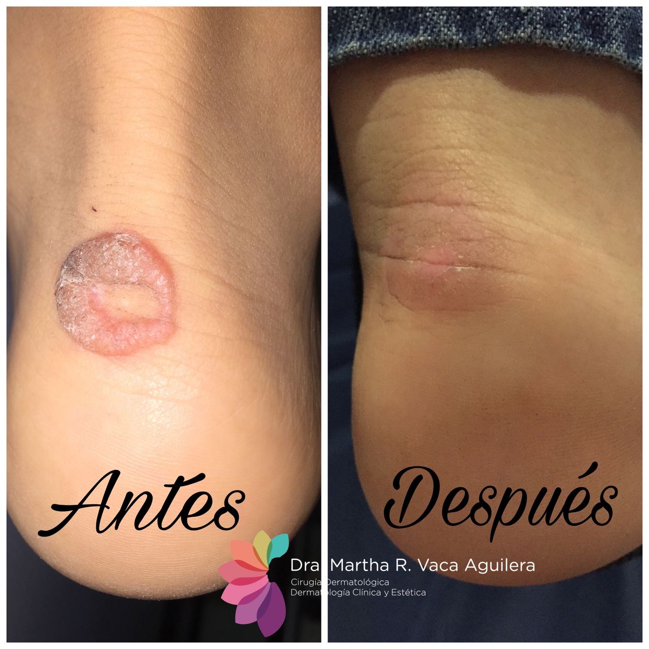 Martha Rosa Vaca Aguilera-4