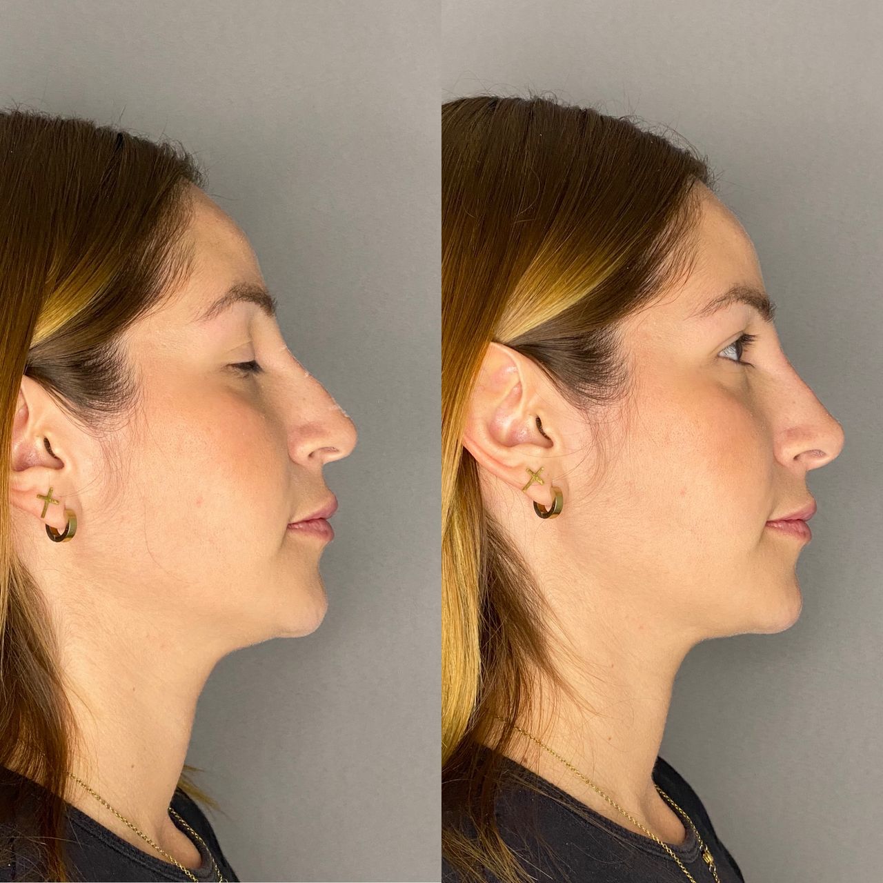 Juan Antonio Munguia Baltodano-6