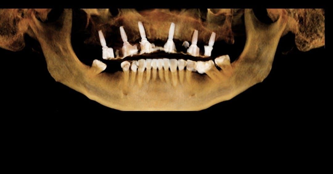 Carlos Ernesto Contreras Castellanos-19
