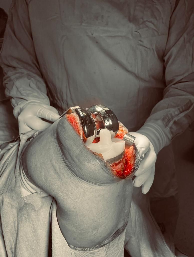 Oscar Alberto Pérez Peralta-15