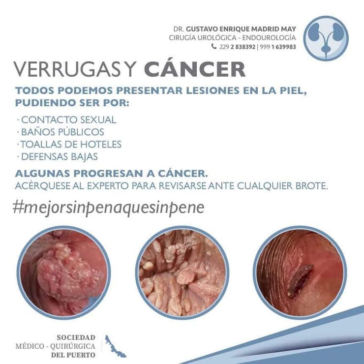 Gustavo Enrique Madrid May-9