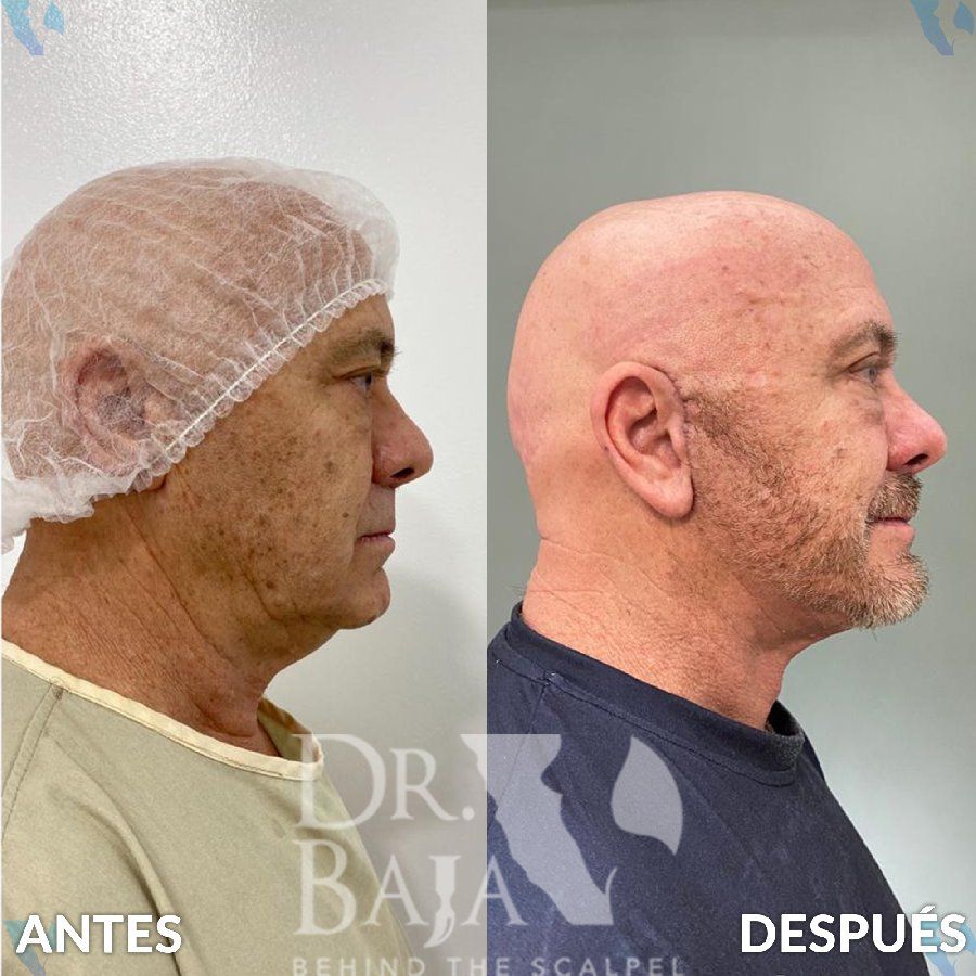 Renato Rodríguez Hirales-33