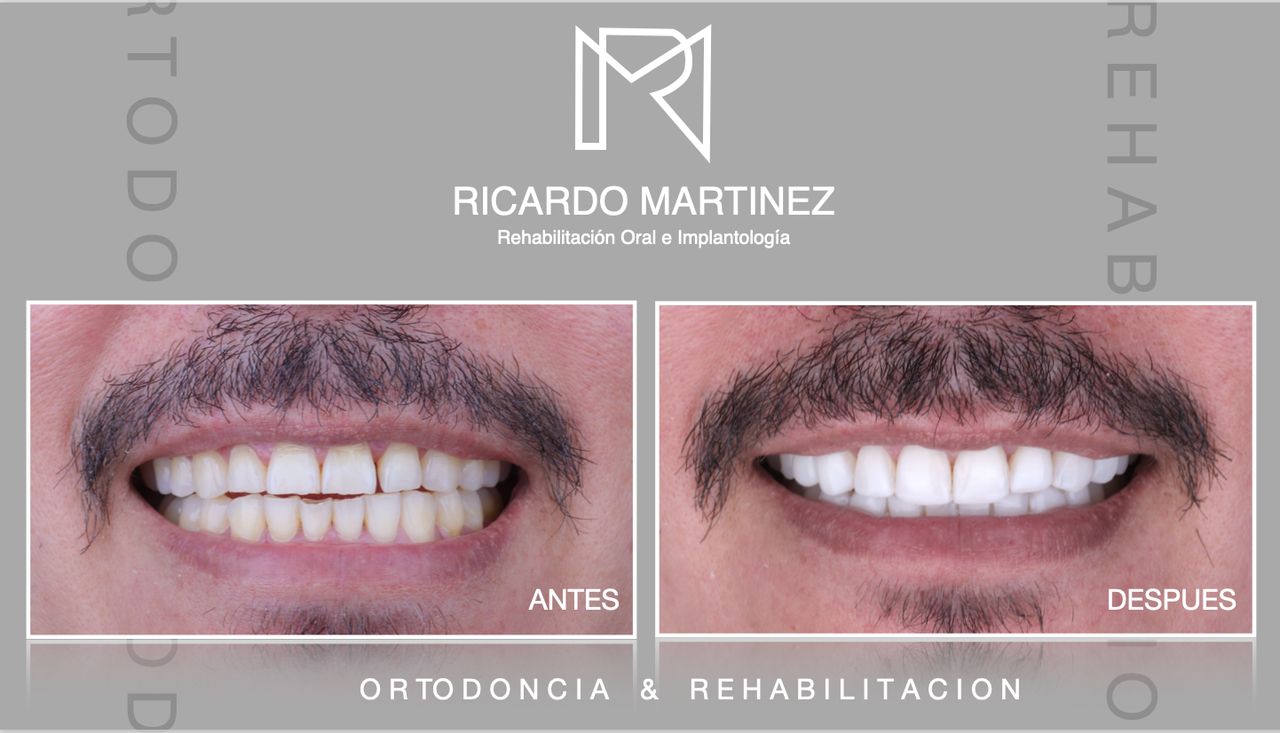 J. Ricardo Martínez-8