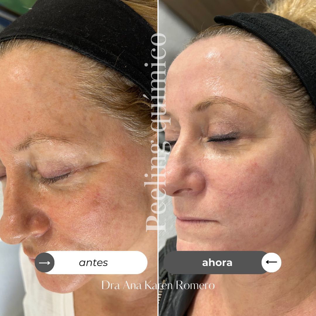 Ana Karen Romero Guzmán-4